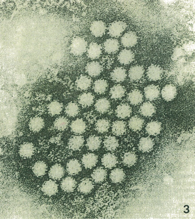 図1.免疫電子顕微鏡により最初に発見された小型球形ウイルス（SRSV)
