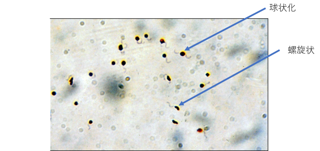 図１．カンピロバクターの球状化　顕微鏡写真（鞭毛染色）